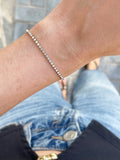Pulsera circonitas